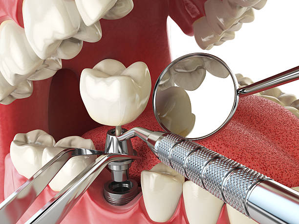 Best Emergency Dentist for Knocked-Out Tooth in Hampton Beach, NH
